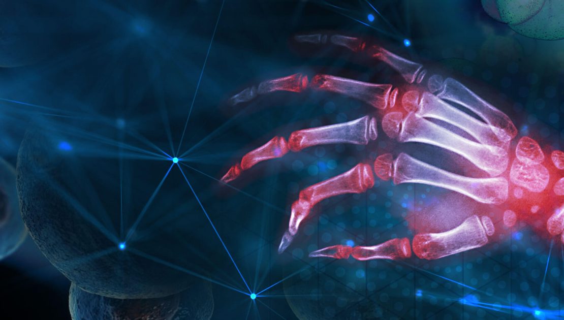 Best Rheumatology Treatment In Chembur