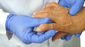 doctors hands and rheumatology affected hand