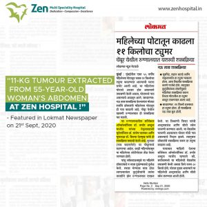 11kg tumour extracted from 55-years old womans abdomen