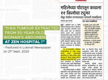 11kg tumour extracted from 55-years old womans abdomen