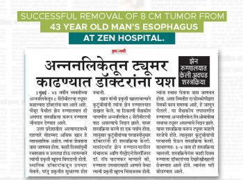 Successful removal fo 8cm tumor from 43 years old man