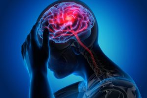 Brain stroke treatment in Mumbai