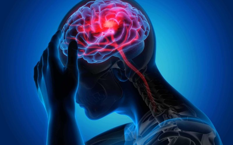 Brain stroke treatment in Mumbai