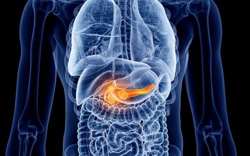 PancreatitisandPancreaticCancer_share