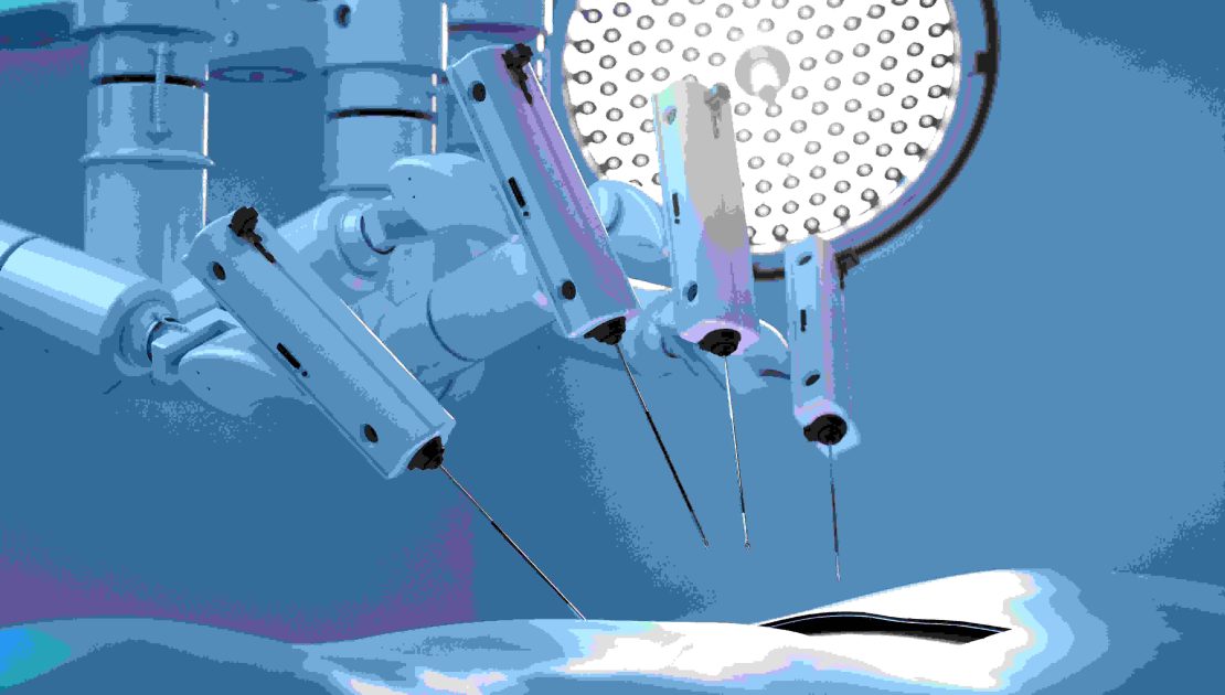 Robotic Surgery