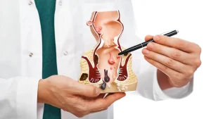 Fistula treatment in Chembur