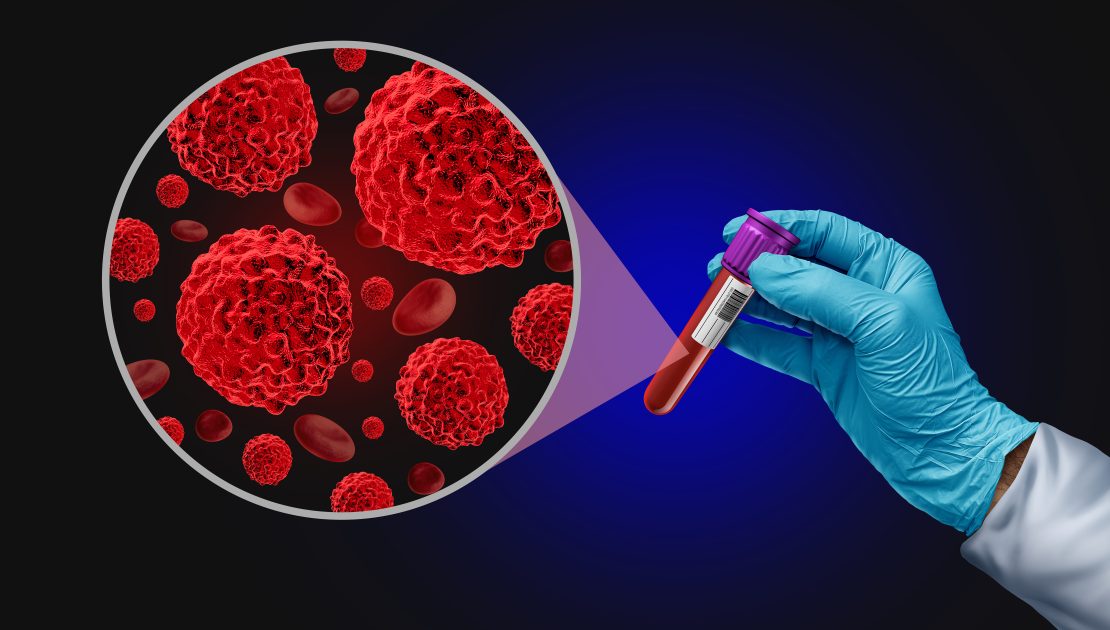Cancer Hospital in Mumbai