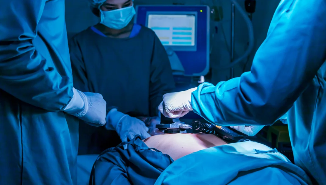 Laparoscopic Surgeon in Mumbai | Gallstone Surgery