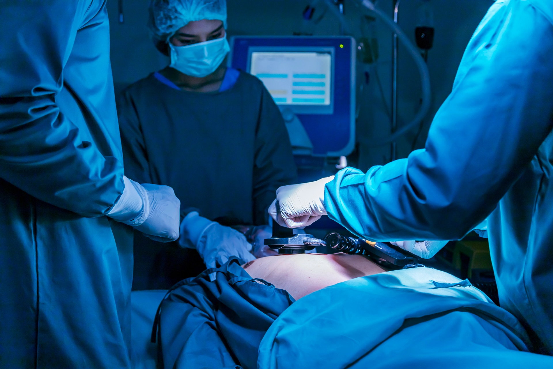 Laparoscopic Surgeon in Mumbai Laparoscopic Surgeon in Mumbai | Gallstone Surgery